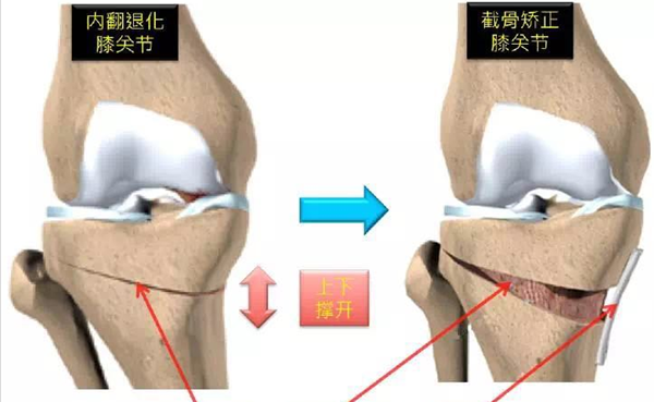 图片1_副本.png