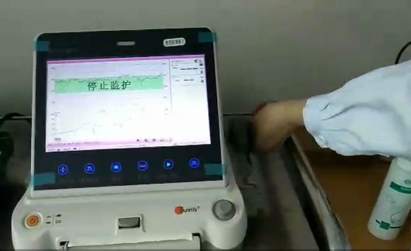 胎心监护操作视频.JPG