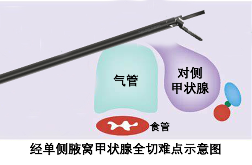 图片二.png