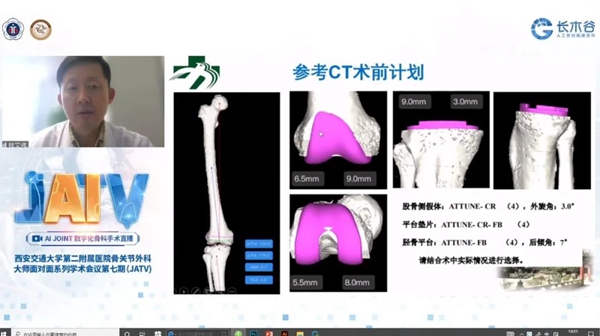 北京协和钱文伟教授线上授课_副本.jpg