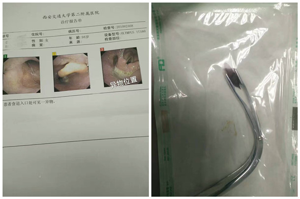 1-患者电子喉镜检查结果_副本.jpg