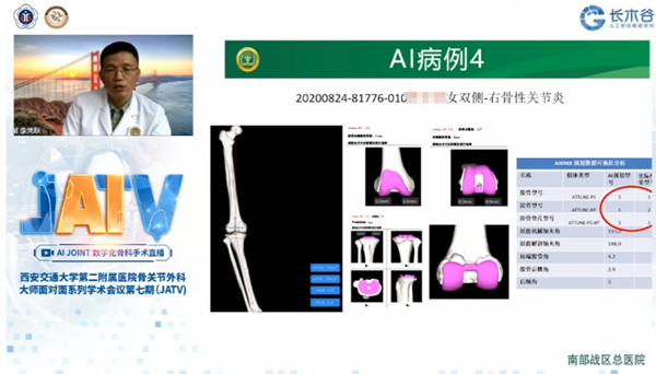 南部战区总医院李凭跃教授授课_副本.png