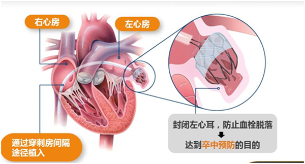 微信图片_20180912154852.png