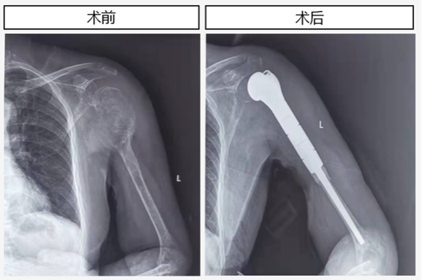图片11_副本.png