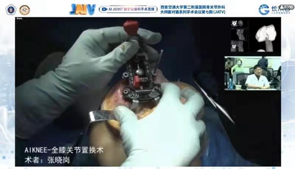 新疆医科大学一附院张晓岗教授AIKNEE手术演示_副本.jpg