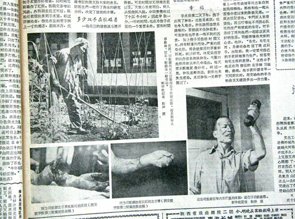 2.断手再植.jpg