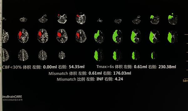 e-Stroke软件_副本.jpg